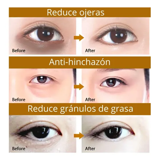 Pack de 10 Pares de Máscaras para Ojeras Flower Secret